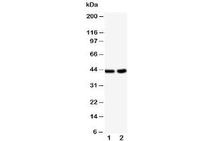 Western blot testing of BCAT1 antibody and Lane 1:  HeLa (BCAT1 anticorps  (C-Term))