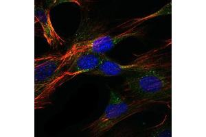 Immunofluorescence analysis of NIH/3T3 cells using GKAP mouse mAb (green).