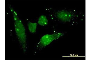 Immunofluorescence of monoclonal antibody to FGFR2 on HeLa cell.