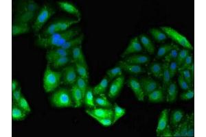 Immunofluorescent analysis of HepG2 cells using ABIN7143616 at dilution of 1:100 and Alexa Fluor 488-congugated AffiniPure Goat Anti-Rabbit IgG(H+L)