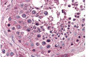 Human Testis (formalin-fixed, paraffin-embedded) stained with OPN3 antibody ABIN399999 at 5 ug/ml followed by biotinylated goat anti-rabbit IgG secondary antibody ABIN481713, alkaline phosphatase-streptavidin and chromogen.