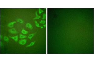 Iunofluorescence analysis of HepG2 cells, using P-10 antibody. (MMP10 anticorps)