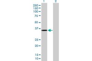 Western Blot analysis of CRHBP expression in transfected 293T cell line by CRHBP MaxPab polyclonal antibody. (CRHBP anticorps  (AA 1-322))