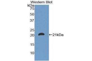 Western Blotting (WB) image for anti-CD8b Molecule (CD8B) (AA 22-170) antibody (ABIN1858318) (CD8B anticorps  (AA 22-170))