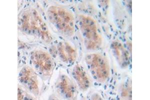 Figure. (CCL4 anticorps  (AA 24-92))