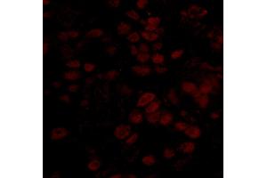 Immunofluorescence (IF) image for anti-BRCA2 and CDKN1A Interacting Protein (BCCIP) (AA 300-350) antibody (ABIN7448933) (BCCIP anticorps  (AA 300-350))