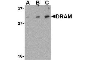 Western blot analysis of DRAM in K562 cell lysate with AP30305PU-N DRAM antibody at (A) 0. (DRAM anticorps  (N-Term))