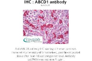 Image no. 1 for anti-ATP-Binding Cassette, Sub-Family D (Ald), Member 1 (ABCD1) antibody (ABIN1731416)