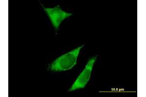 Immunofluorescence of purified MaxPab antibody to RPTOR on HeLa cell. (Raptor anticorps  (AA 1-379))