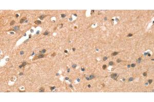Immunohistochemistry of paraffin-embedded Human brain using CRELD1 Polyclonal Antibody at dilution of 1:40 (CRELD1 anticorps)