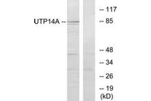 Western blot analysis of extracts from HeLa cells, using UTP14A Antibody. (UTP14A anticorps  (AA 321-370))