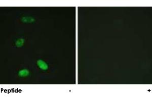Immunofluorescence analysis of HeLa cells, using MYB polyclonal antibody . (MYB anticorps  (Ser12))