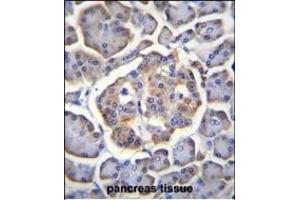 BTBD17 Antibody (C-term) (ABIN655567 and ABIN2845068) immunohistochemistry analysis in formalin fixed and paraffin embedded human pancreas tissue followed by peroxidase conjugation of the secondary antibody and DAB staining.