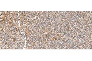 Immunohistochemistry of paraffin-embedded Human tonsil tissue using GIMAP2 Polyclonal Antibody at dilution of 1:60(x200)