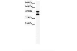 Image no. 2 for anti-Acetyl-CoA Acetyltransferase 2 (ACAT2) (AA 183-232) antibody (ABIN202425) (ACAT2 anticorps  (AA 183-232))