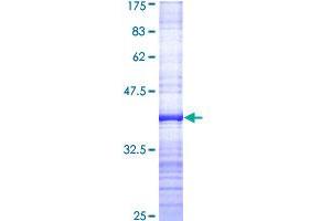 Image no. 1 for Structural Maintenance of Chromosomes 3 (SMC3) (AA 711-810) protein (GST tag) (ABIN1320659)