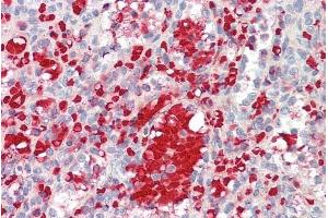 anti-Insulin-Like Growth Factor 1 (IGF1) (Internal Region) antibody