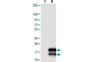 Western blot analysis of Lane 1: Negative control (vector only transfected HEK293T lysate). (TYROBP anticorps)