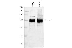 Western blot analysis of ErbB 2 using anti-ErbB 2 antibody (ABIN5518830). (ErbB2/Her2 anticorps  (N-Term))