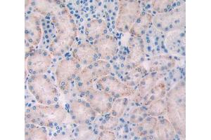 IHC-P analysis of kidney tissue, with DAB staining. (FLT1 anticorps  (AA 303-524))