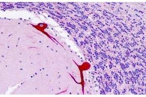 Human Brain, Cerebellum: Formalin-Fixed, Paraffin-Embedded (FFPE) (DAB1 anticorps  (AA 187-236))