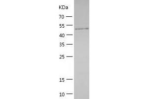 Western Blotting (WB) image for Protein Phosphatase 1F (PP2C Domain Containing) (PPM1F) (AA 1-454) protein (His-IF2DI Tag) (ABIN7124670)