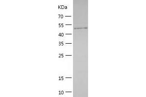 Western Blotting (WB) image for Protein Phosphatase 1F (PP2C Domain Containing) (PPM1F) (AA 1-454) protein (His tag) (ABIN7124670)