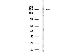 Western blot analysis of lysates from COLO205 cells(heat-shock,45 min treatment), using Phospho-EGFR (Ser695) Antibody at 1/1000 dilution.