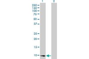 Western Blot analysis of E2F2 expression in transfected 293T cell line by E2F2 MaxPab polyclonal antibody. (E2F2 anticorps  (AA 1-83))