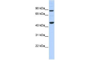 WB Suggested Anti-PPME1 Antibody Titration: 0. (PPME1 anticorps  (N-Term))