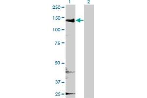 Western Blot analysis of CYFIP2 expression in transfected 293T cell line by CYFIP2 monoclonal antibody (M01), clone 4G6. (CYFIP2 anticorps  (AA 733-820))
