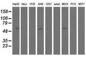 Image no. 15 for anti-5'-Nucleotidase Domain Containing 1 (NT5DC1) antibody (ABIN1499837)
