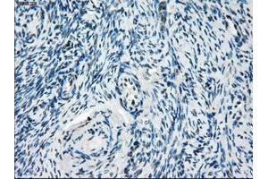 Immunohistochemical staining of paraffin-embedded colon tissue using anti-ZFP36 mouse monoclonal antibody.