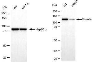 Western blotting analysis using Vinculin antibody (ABIN7800842). (Recombinant Vinculin anticorps)