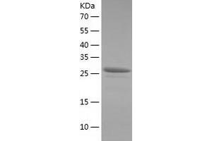 Western Blotting (WB) image for Tetratricopeptide Repeat Domain 1 (TTC1) (AA 1-292) protein (His-IF2DI Tag) (ABIN7125340)