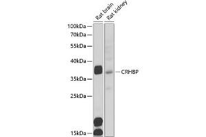 Western blot analysis of extracts of various cell lines, using CRHBP antibody (ABIN6129571, ABIN6139030, ABIN6139033 and ABIN6222243) at 1:1000 dilution.