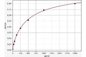 Angiopoietin-Like 2 (ANGPTL2) ELISA Kit