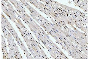 IHC analysis of Cyclophilin E/PPIE using anti-Cyclophilin E/PPIE antibody (ABIN7599242). (PPIE anticorps  (AA 1-301))
