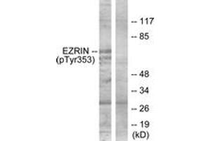 Western blot analysis of extracts from A431 cells treated with EGF 200ng/ml 30', using Ezrin (Phospho-Tyr353) Antibody. (Ezrin anticorps  (pTyr354))
