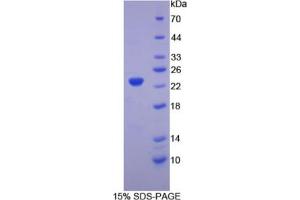 SDS-PAGE analysis of Chicken Hemoglobin beta Protein. (Hemoglobin Subunit beta Protéine)