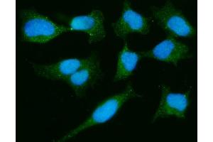 IF analysis of PARK7/DJ1 using anti-PARK7/DJ1 antibody (ABIN7600468). (PARK7/DJ1 anticorps  (AA 2-189))