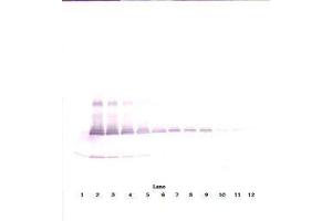 Image no. 3 for anti-Interleukin 17A (IL17A) antibody (ABIN465353) (Interleukin 17a anticorps)