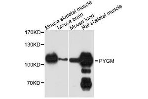 Western blot analysis of extracts of various cell lines, using PYGM antibody. (PYGM anticorps  (C-Term))