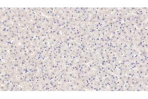 Detection of ROS1 in Human Liver Tissue using Monoclonal Antibody to C-Ros Oncogene 1, Receptor Tyrosine Kinase (ROS1)