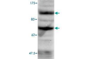 B. (ASH2L anticorps)