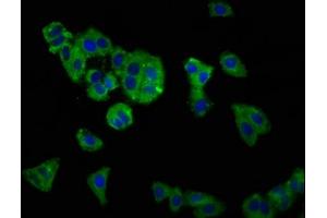 Immunofluorescence staining of HepG2 cells with ABIN7170083 at 1:166, counter-stained with DAPI. (KCC2 anticorps  (AA 944-1071))