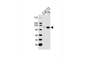 Lane 1: Mouse C2C12 Cell Lysates, Lane 2: Rat L6 Cell Lysates, probed with Musk (1429CT456. (MUSK anticorps)