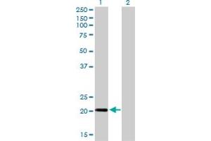 Western Blot analysis of CETN3 expression in transfected 293T cell line by CETN3 monoclonal antibody (M01), clone 3E6.
