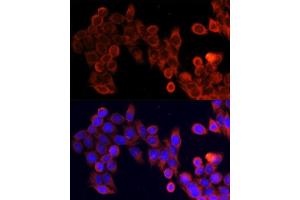 Immunofluorescence analysis of HeLa cells using MTOR antibody. (MTOR anticorps)