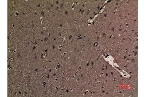 Immunohistochemistry (IHC) analysis of paraffin-embedded Human Brain, antibody was diluted at 1:100.
